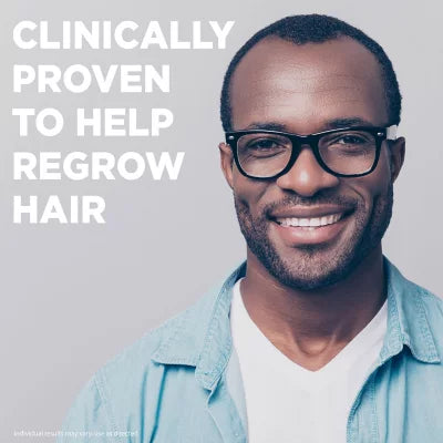 Member's Mark Minoxidil Topical Aerosol 5% (Foam) | Reactivates Hair Follicles to Stimulate Growth | Hair Regrowth | Similar to Rogaine | Treatment For Men | 1 Month Supply | 2.11oz/60g; Exp 04/2026