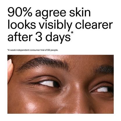 INKEY List Salicylic Acid Cleanser | Daily Acne-Busting & Oil Reducing Cleanser | 150ml; Exp 10/2026