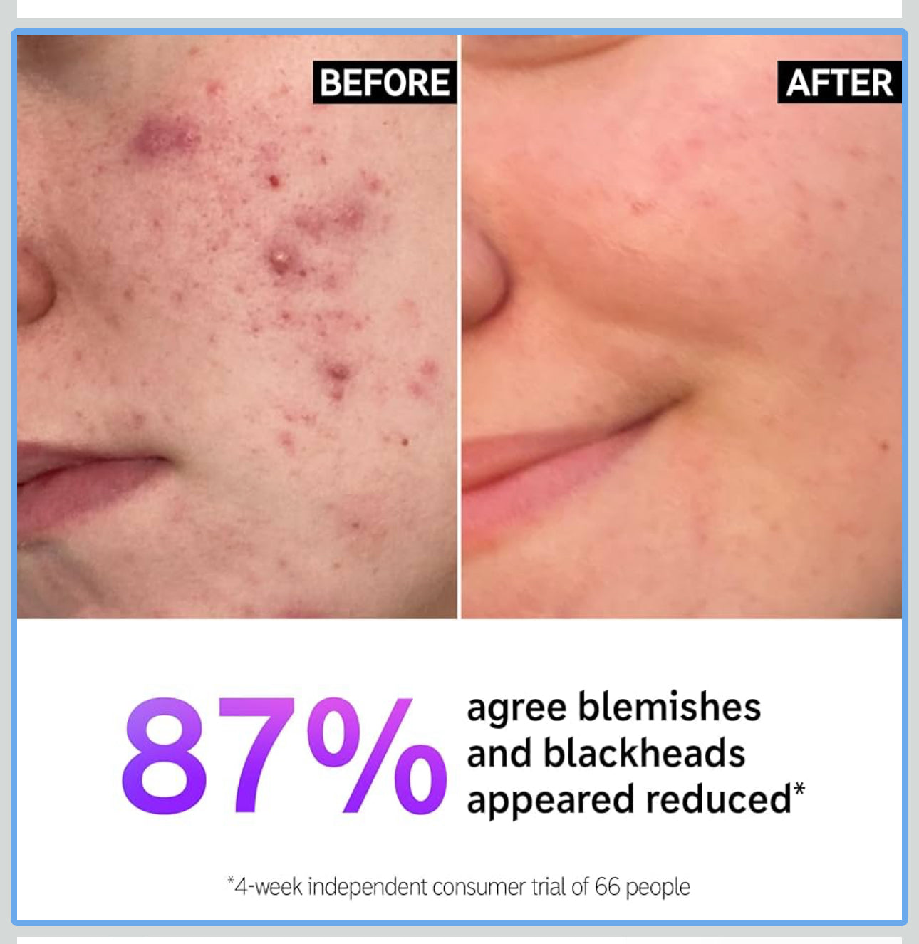 The INKEY List Salicylic Acid Cleanser | Face Wash for Blemishes, Blackheads, Oily Skin and Breakouts | Non-Drying Facial Cleanser Safe for All Skin Types | 150ml; Exp 01/2026