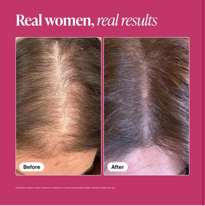 Viviscal Advanced Hair Growth Supplement | For Women For Thicker, Fuller Hair, Nourishes Thinning & Loss | With Proprietary Collagen Complex | 100% Drug Free | 1 Month Supply | 60 Tablets; Exp 04/2026