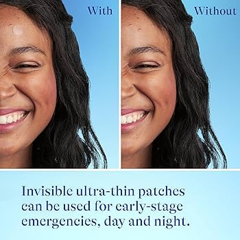 Differin Acne-Prone Pimple Patches | Formulated with Salicylic Acid and Centella | Fast Triple Action Power Patch for Day & Night | 36 Patches