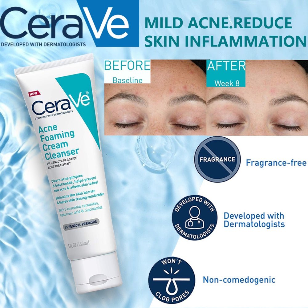 CeraVe Acne Foaming Cream Cleanser (4% Benzoyl Peroxide) Exp 05/2025 - Ome's Beauty Mart