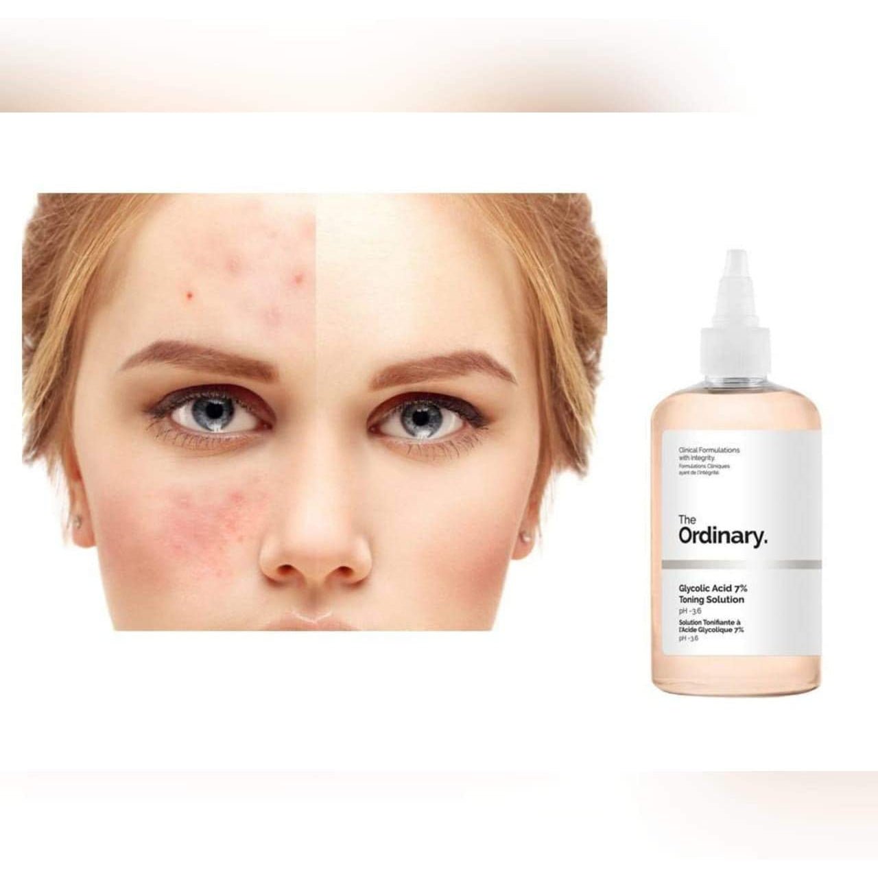 The Ordinary Glycolic Acid 7% Toning Solution 240ml - Ome's Beauty Mart